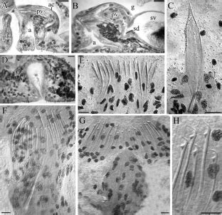  Otoplana: Eine Meisterin der Regeneration und des Fliessens!