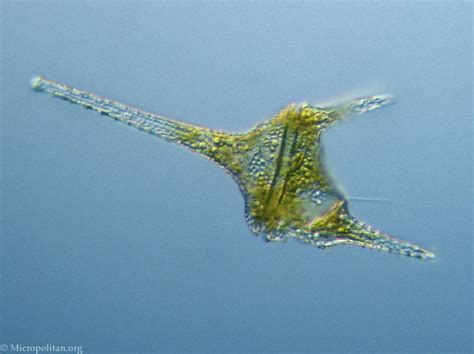  Armored Dinoflagellate:  Erfahren Sie mehr über diese faszinierende einzellige Kreatur mit Panzerung!