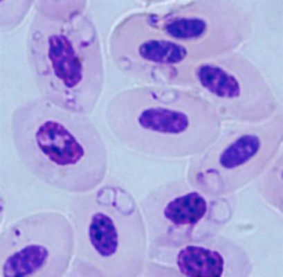  Babesia! Ein winziger Parasit mit großer Wirkung auf Säugetiere und Menschen