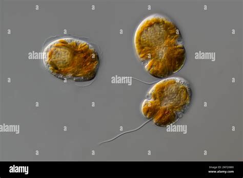  Gymnodinium: Ein winziger Algen-Pirat mit einem unstillbaren Hunger für Plankton!