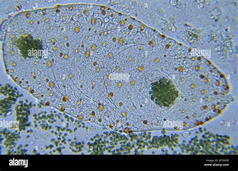  Pelomyxa: Ein unscheinbarer Gigant der mikroskopischen Welt – Beherrscher seiner Umgebung und Meister des Überlebens?